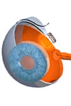 Retina Implantat