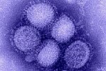 H1N1 influenza virus